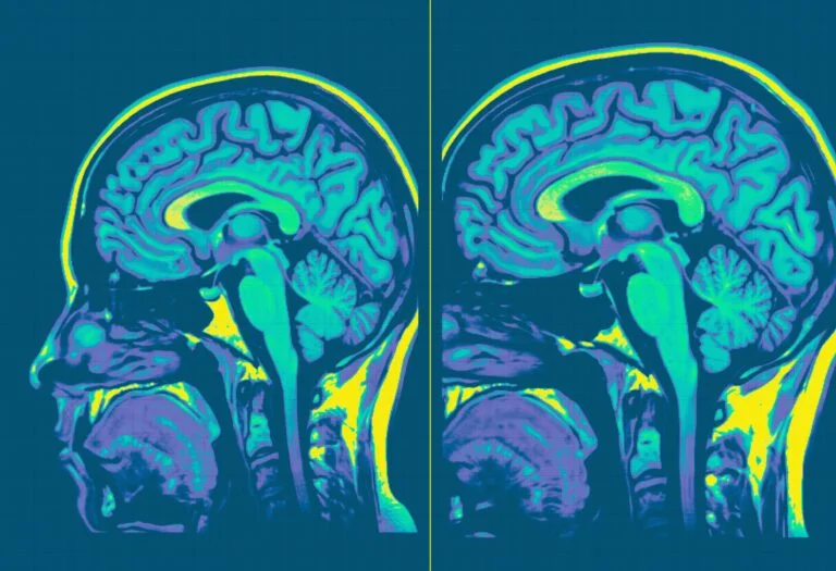 twio colourful mri scans of brain