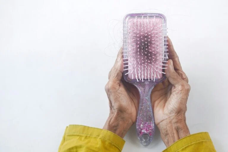 Two hands holding a hairbrush with strands of shed hair caught in the bristles
