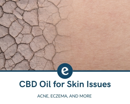 CBD oil for skin issues