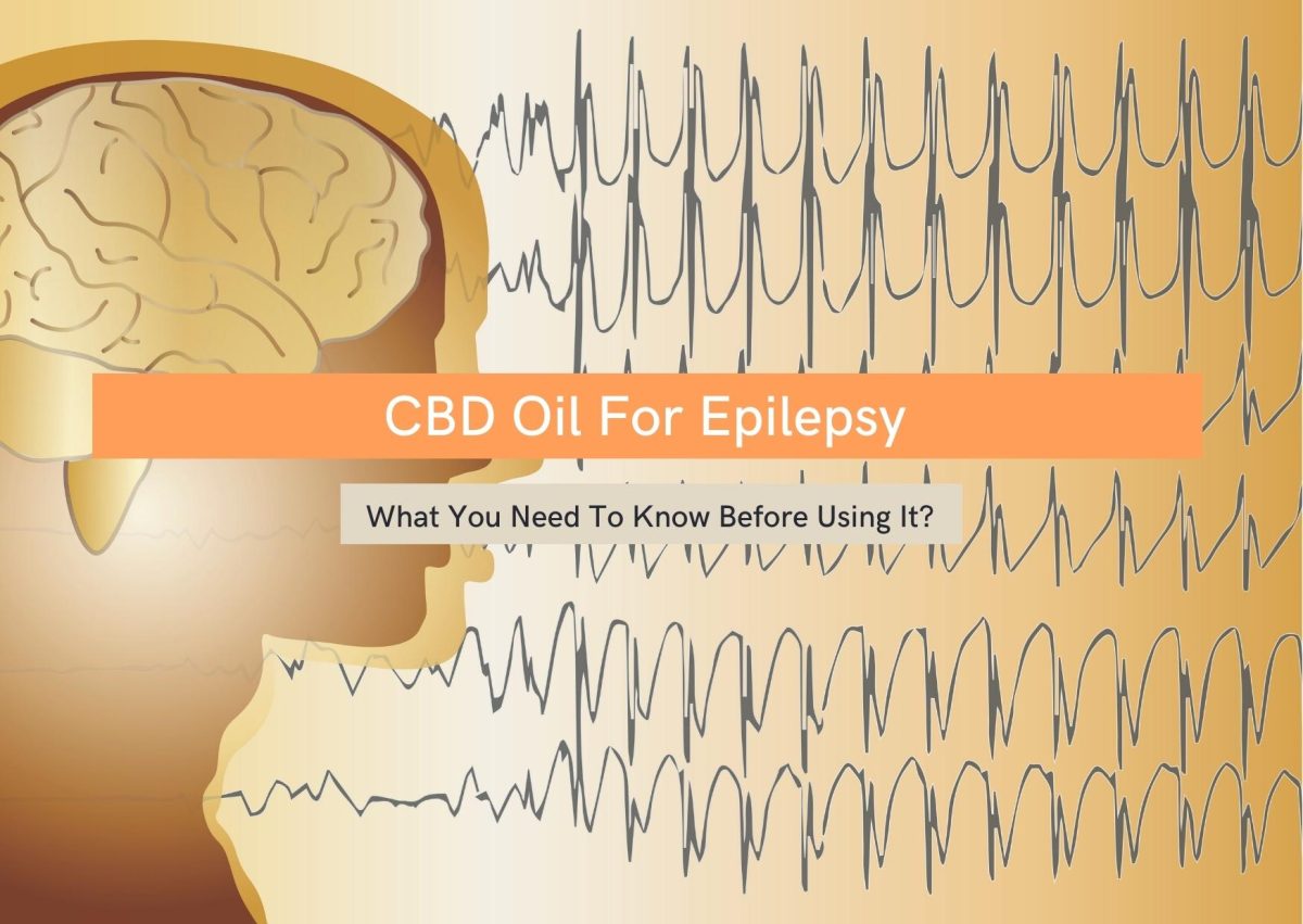 CBD Oil for Epilepsy