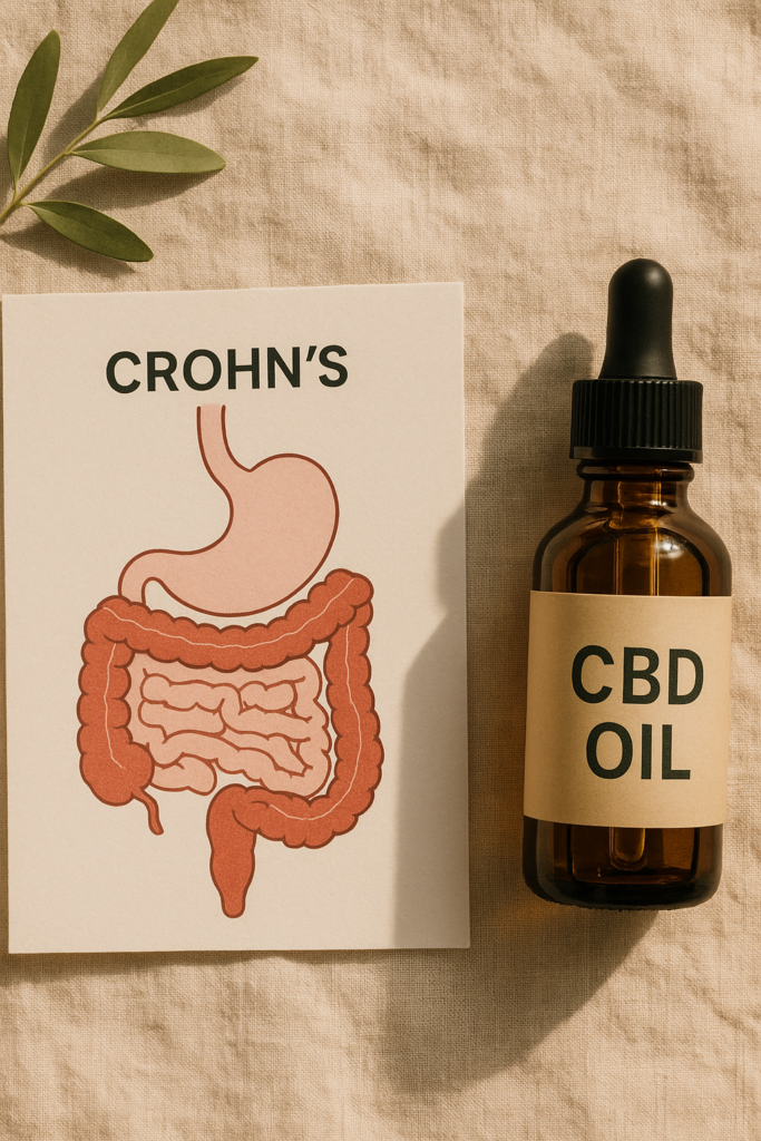 What You Must Know About CBD Oil for Crohn’s Disease