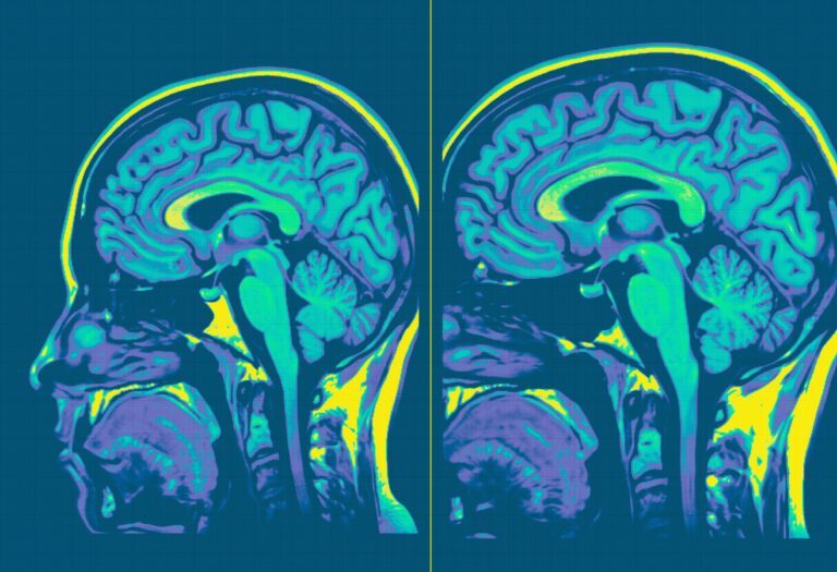 twio colourful mri scans of brain