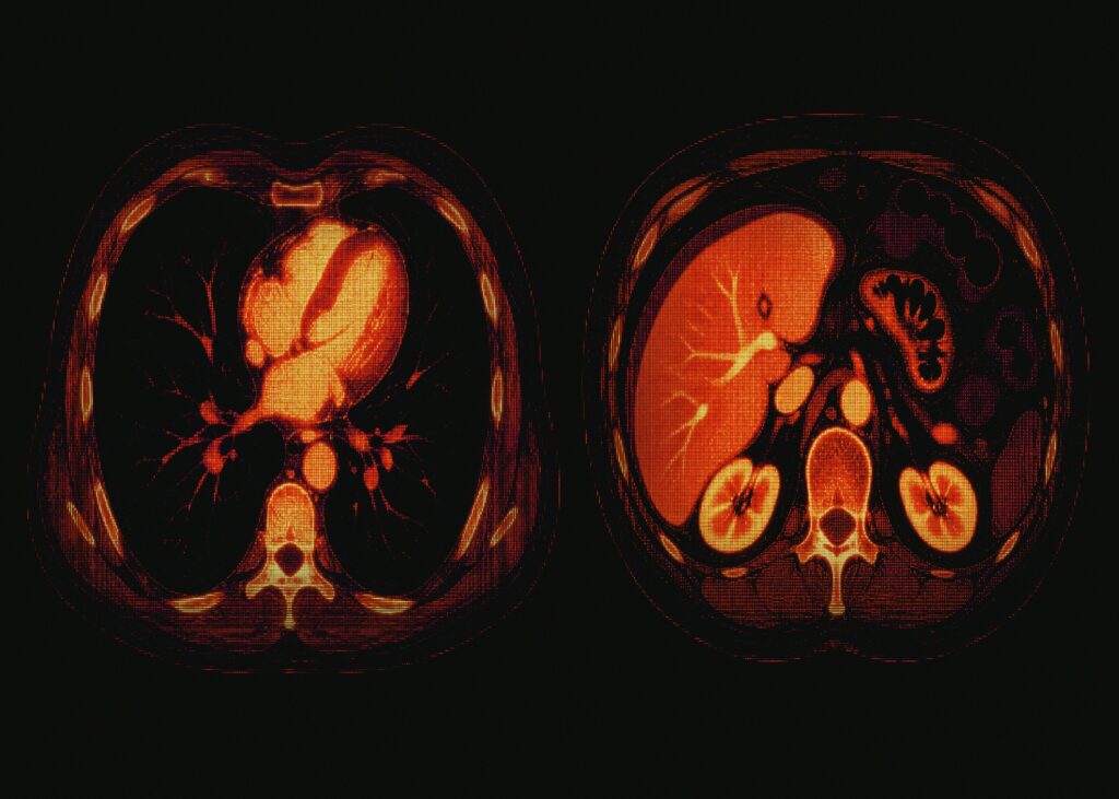 medical scans reveal human heart, liver and kidneys